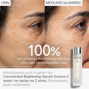 Caudalie Vinoperfect Glycolic Essence – Απολεπιστική Λοσιόν Λάμψης με Γλυκολικό Οξύ, 100ml Καλλυντικά
