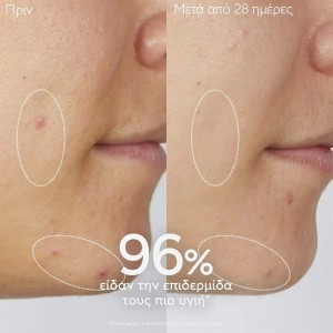 Caudalie Vinopure Purifying Cleanser Gel 150ml – Καθαριστικό Προσώπου κατά των Ατελειών Ακμή