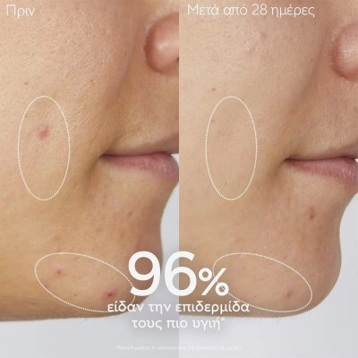 Caudalie Vinopure Purifying Cleanser Gel 150ml – Καθαριστικό Προσώπου κατά των Ατελειών