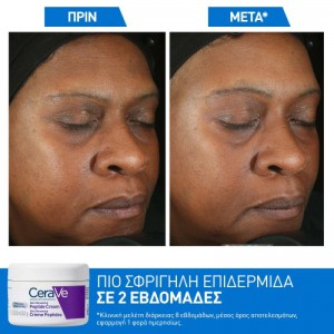 CeraVe Skin Renewing Peptide Κρέμα Προσώπου 48gr Καλλυντικά