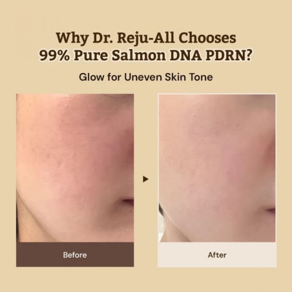 Dr. Reju All Advanced PDRN Rejuvenating Cream 20ml – Κρέμα Αντιγήρανσης με PDRN Το Φαρμακείο προτείνει 