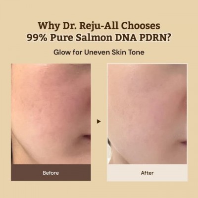 Dr. Reju All Advanced PDRN Rejuvenating Cream 20ml – Κρέμα Αντιγήρανσης με PDRN