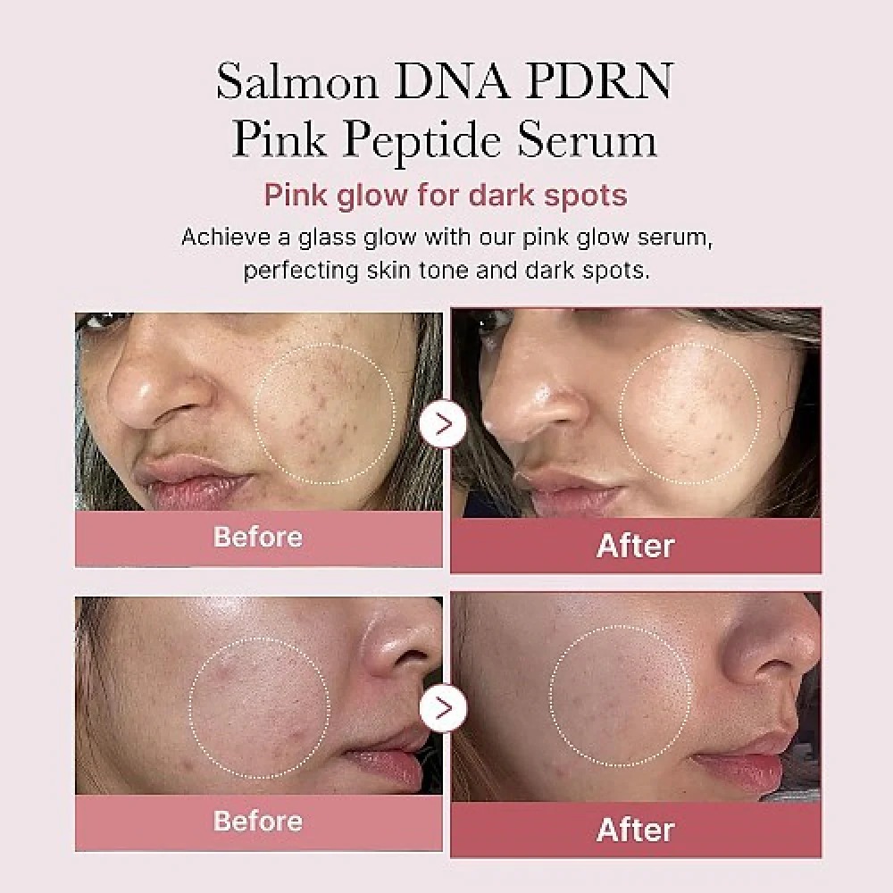 Medicube PDRN Pink Peptide Serum 30ml | Ορός Σύσφιξης & Αναζωογόνησης Αντιγήρανση