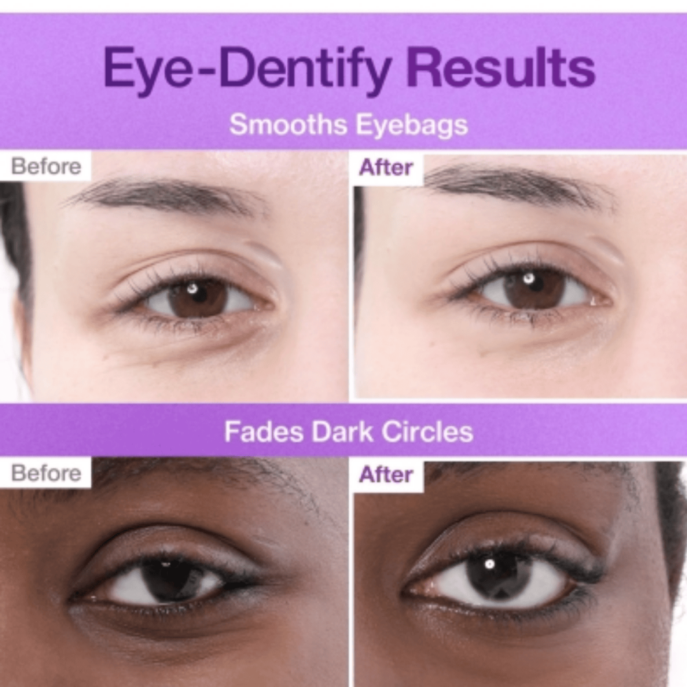 Numbuzin No.9 NAD Collagen Under Eye Patches 5τμχ - Αντιγηραντικά Επιθέματα Ματιών με NAD+ & Κολλαγόνο Αντιγήρανση