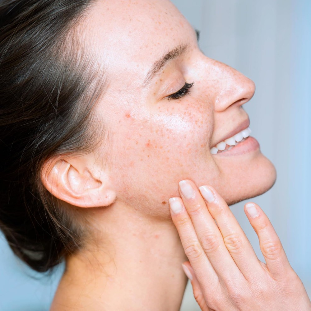 SVR Sebiaclear Micro-Peel 150ml – Απολεπιστική Λοσιόν για Ακμή & Ατέλειες Ακμή
